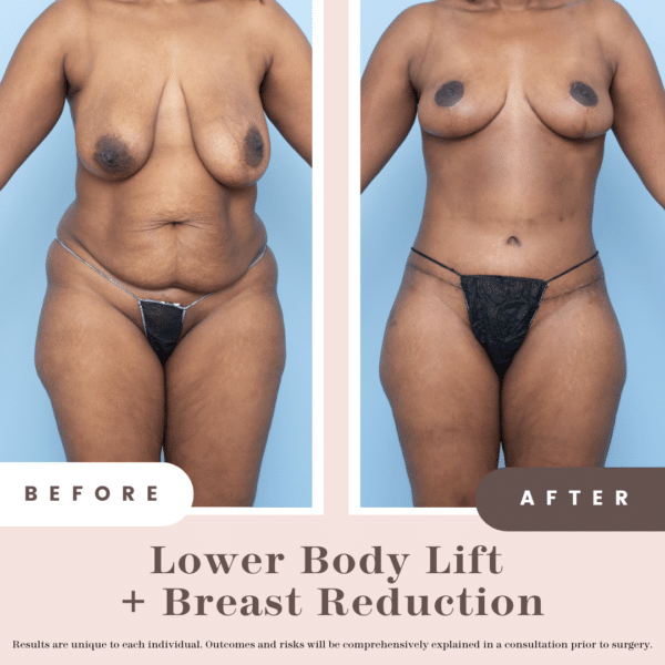 B&a (2)