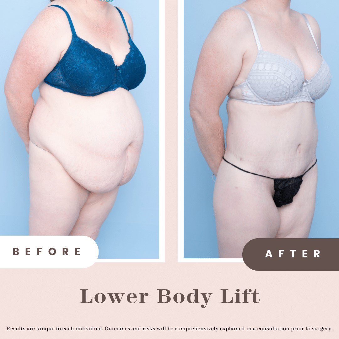before and after