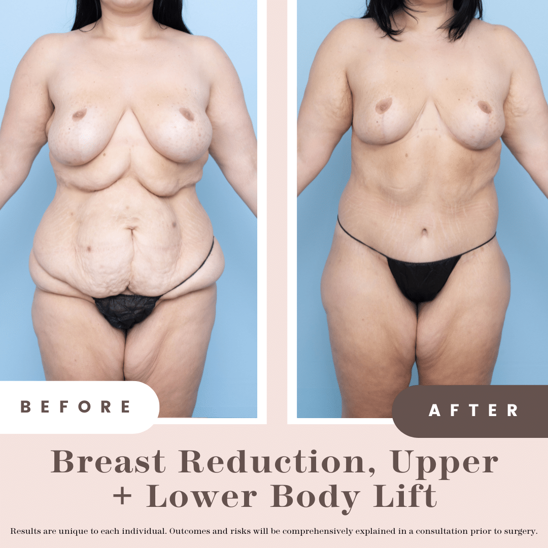 B&a