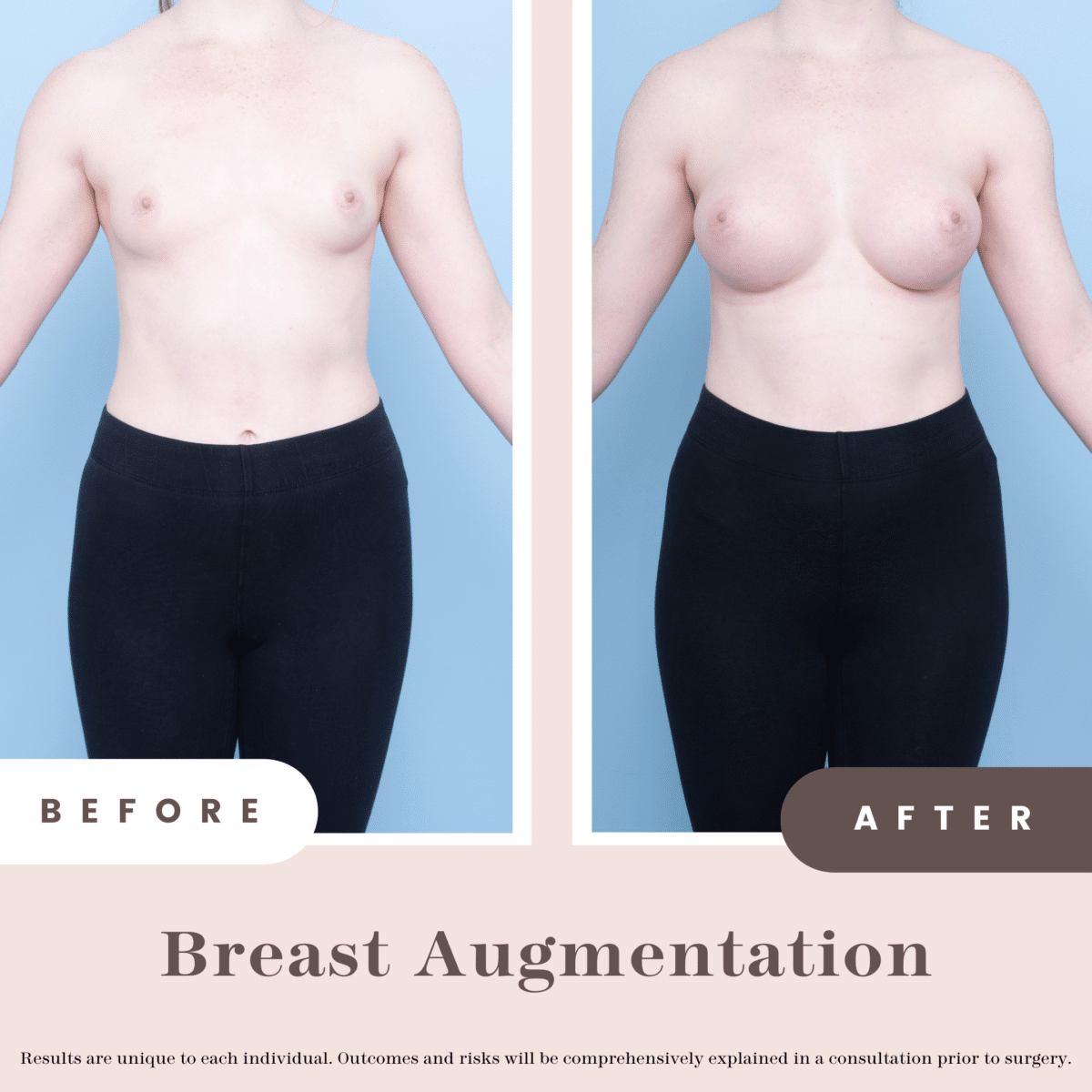 Website B&a 1