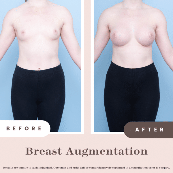 Website B&a 1