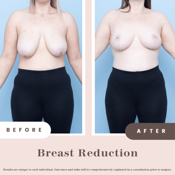 Grace Francis B&a