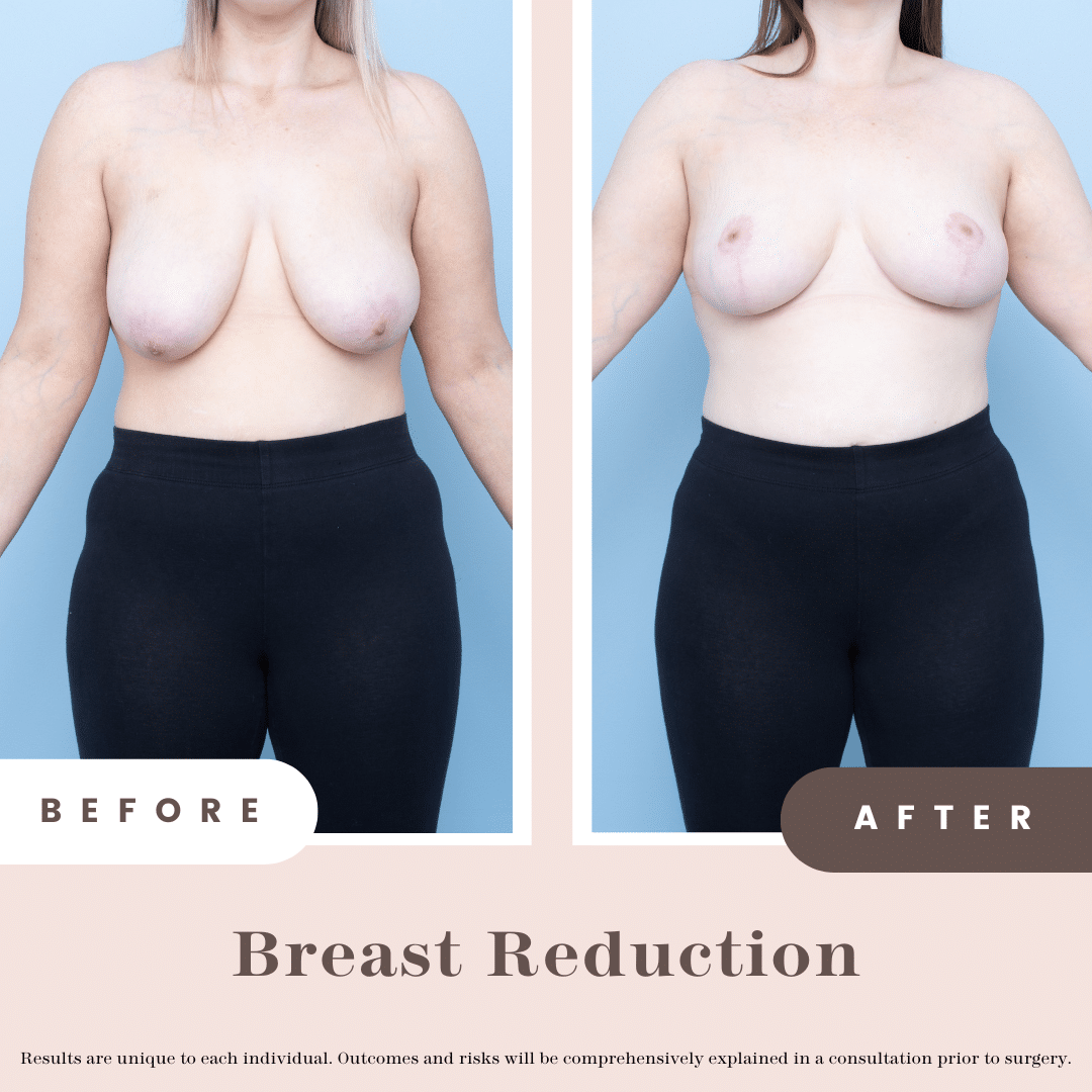 Grace Francis B&a