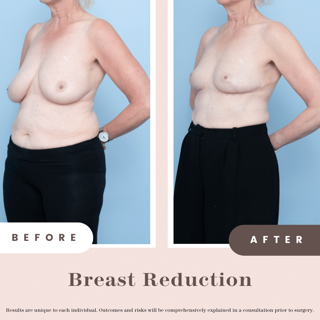 Website B&a (1)