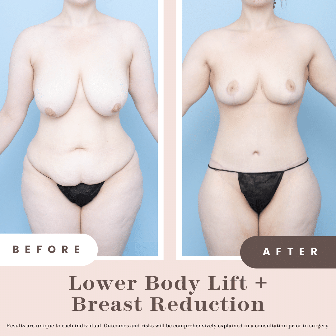Website B&a (1)