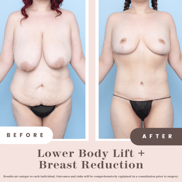 Website B&a (1)