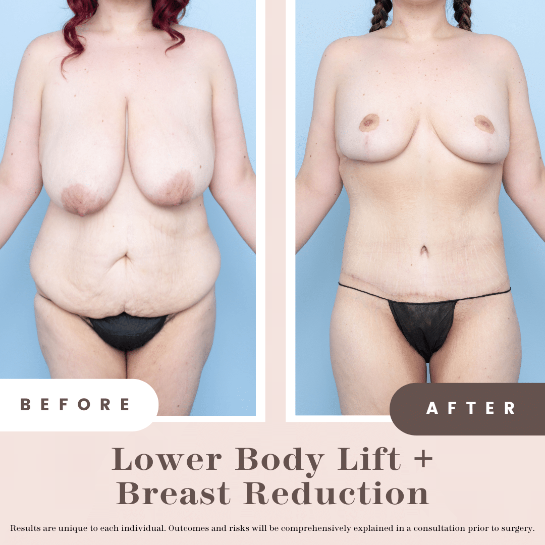 Website B&a (1)