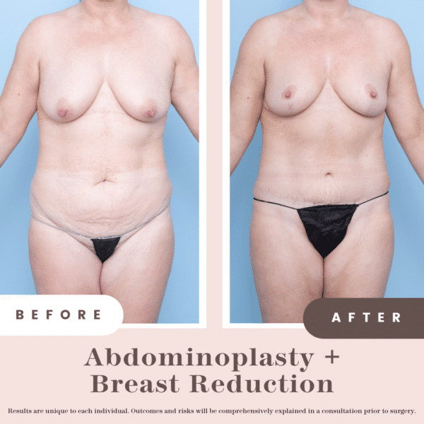 Website B&a (1)