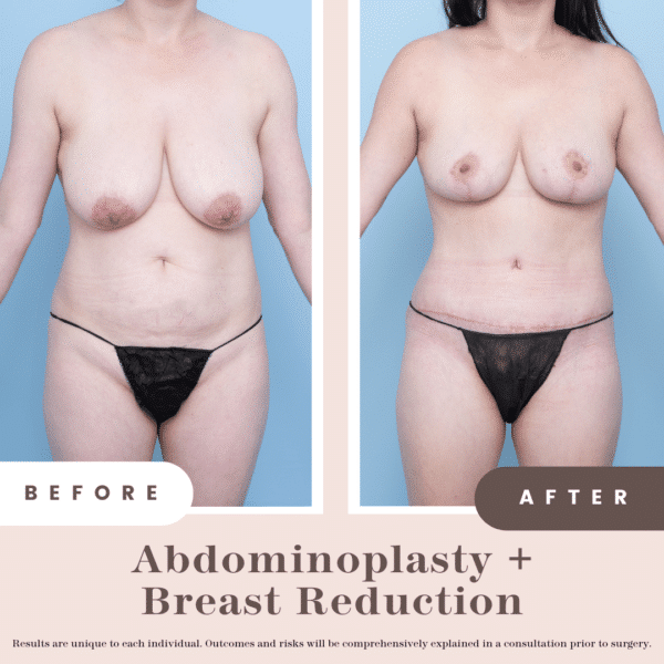 Website B&a (1)