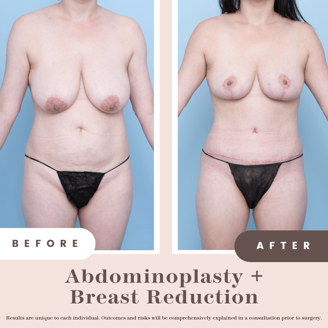 Website B&a (1)