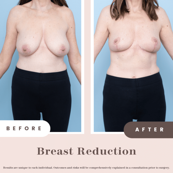 Website B&a