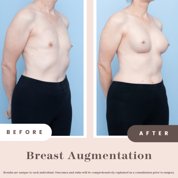 Website B&a