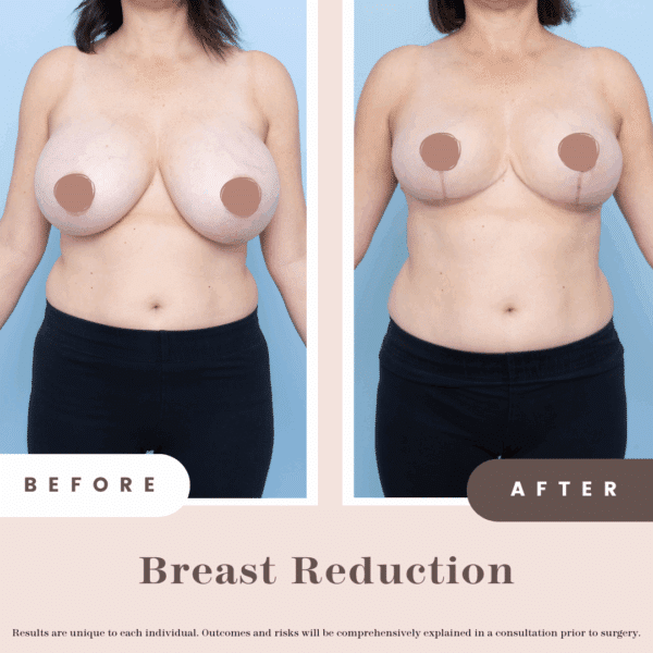 B&a Post 2