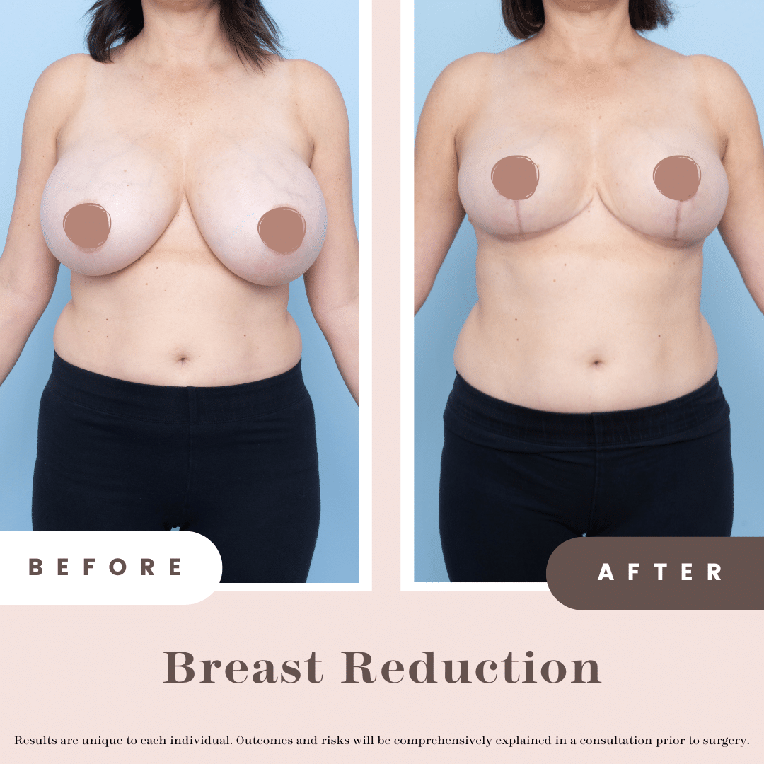 B&a Post 2