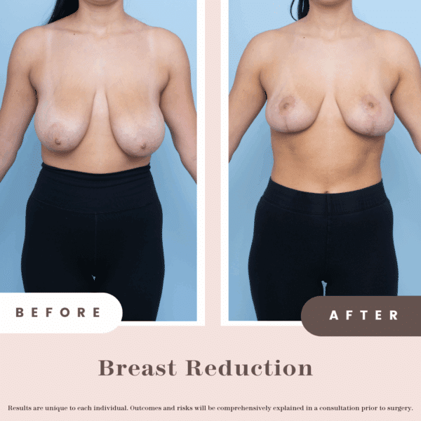 B&a Post (pink)