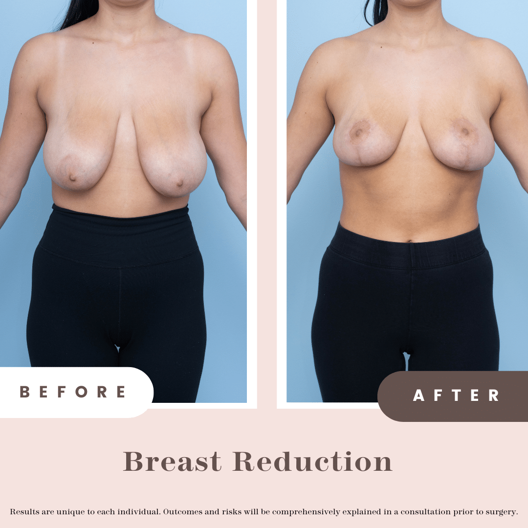B&a Post (pink)