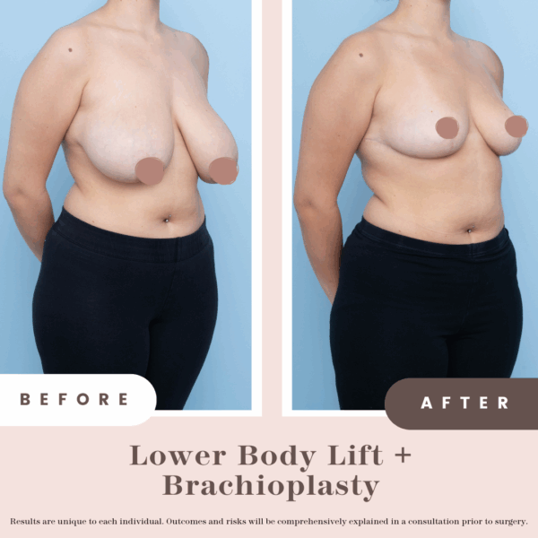 B&a Post (pink) (2)
