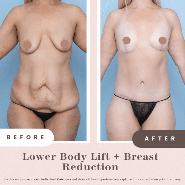 B&a Post (pink)